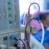 Dialysis or any chronical illness machines